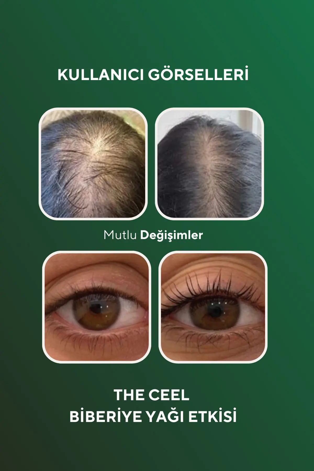 Biberiye Yağı Complexi Saç Dökülmesi ve Yıpranmış Saçlar için Hızlı Saç Uzatan Biotinli Saç Bakımı