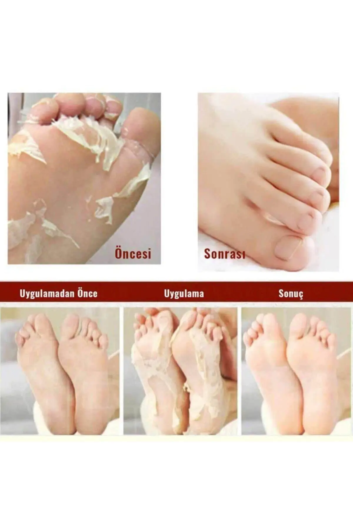 Miracle Foot Peeling Pack - Çorap Tipi Ayak Peeling Maskesi 2'li